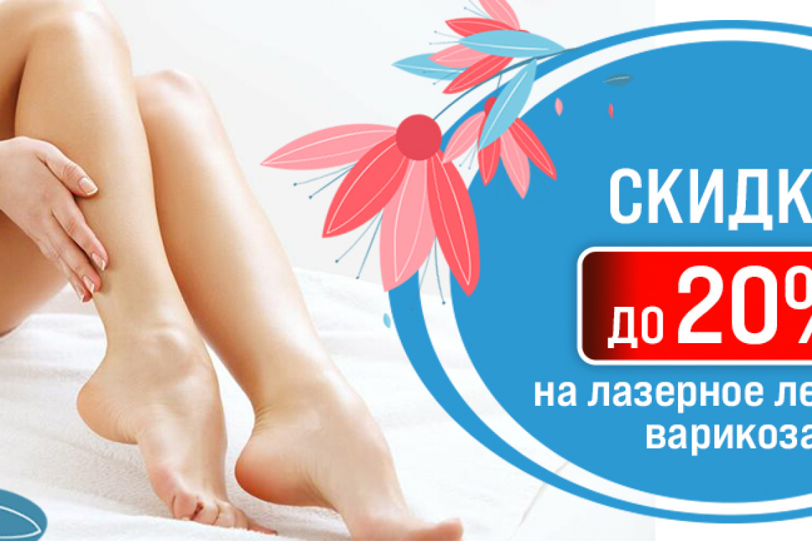 Виды лечения варикозного расширения вен: что нужно знать?